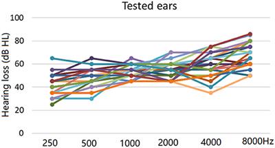 Using Auditory Characteristics to Select Hearing Aid Compression Speeds for Presbycusic Patients